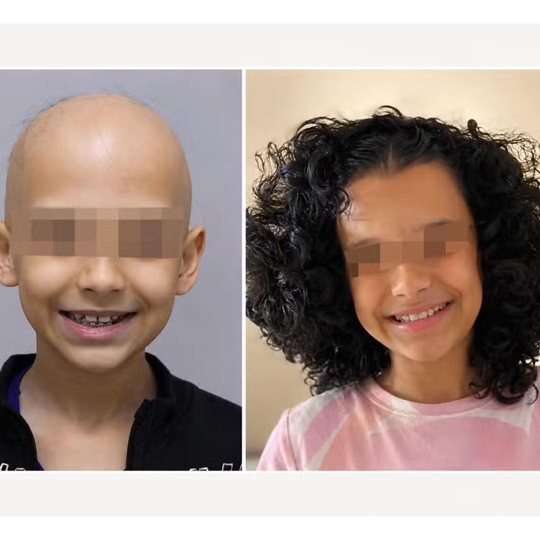 Comparativo de antes e depois 1