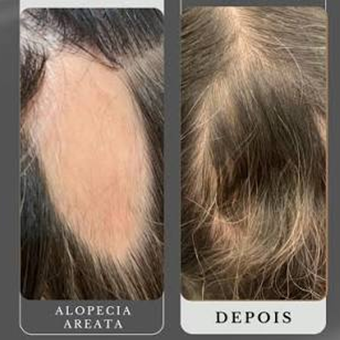 Comparativo de antes e depois 2