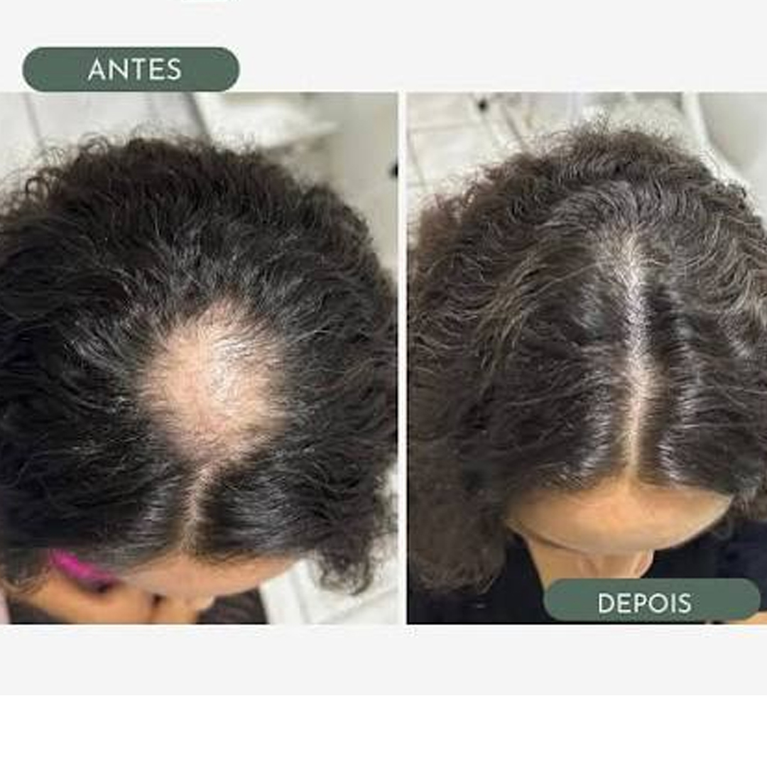 Comparativo de antes e depois 3