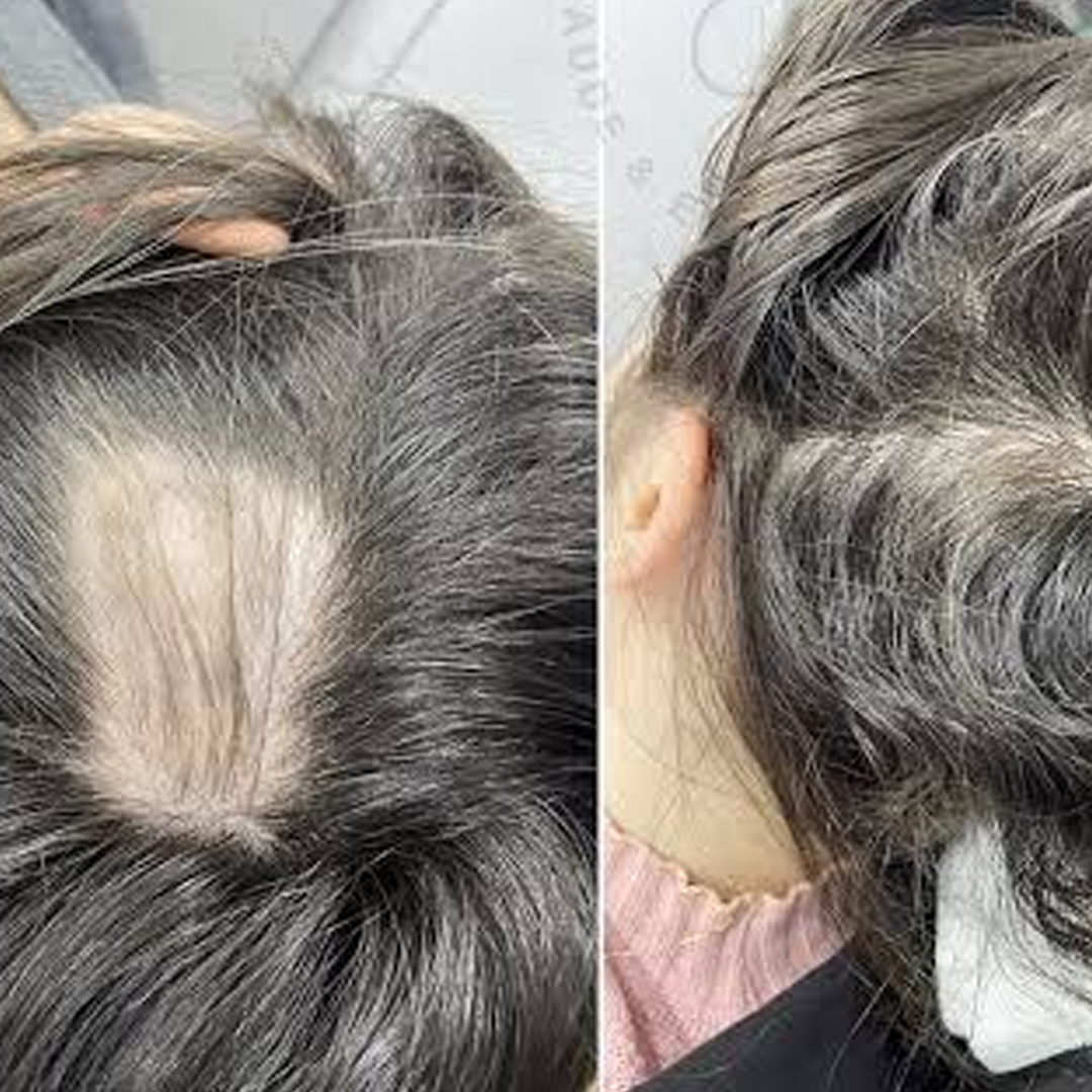 Comparativo de antes e depois 4