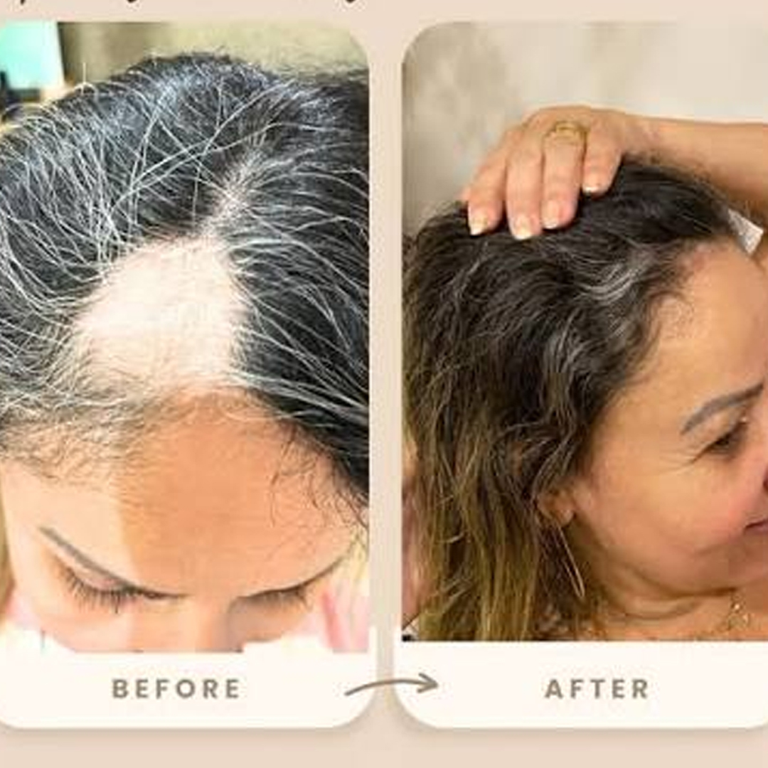 Comparativo de antes e depois 5