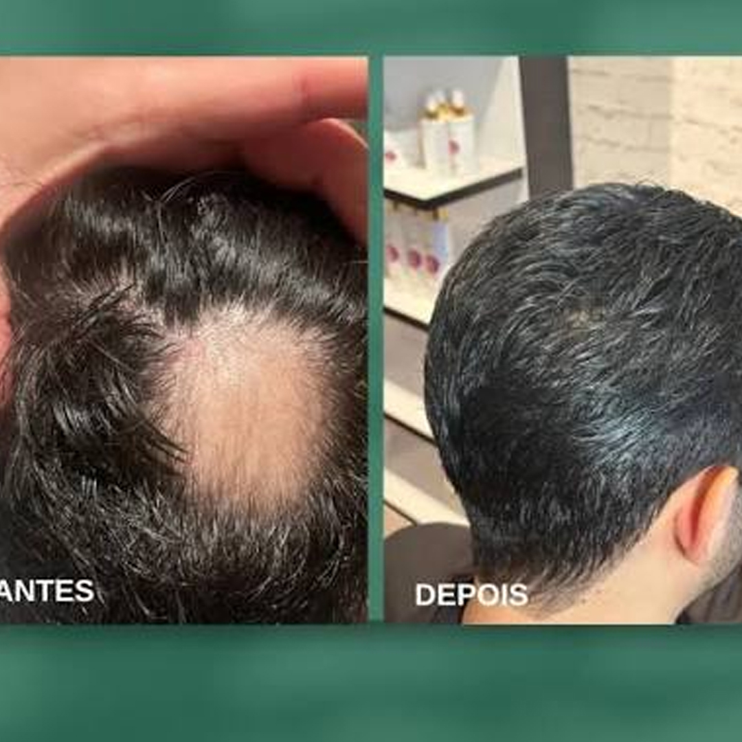 Comparativo de antes e depois 6